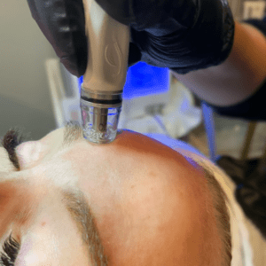 women getting diamond glow facial